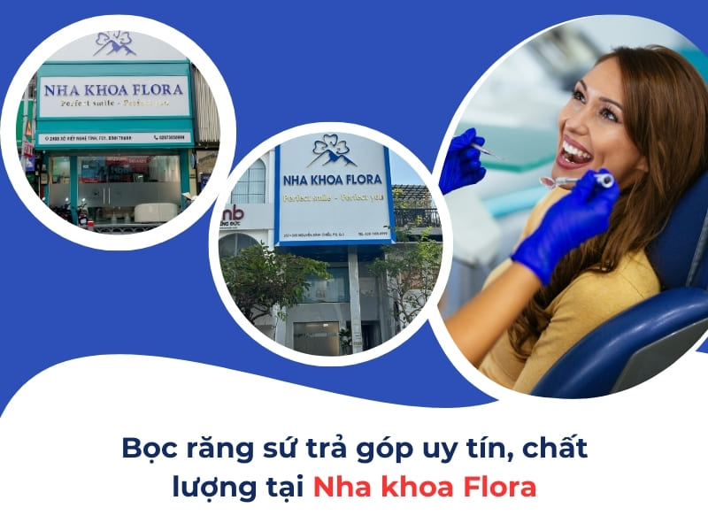 làm răng sứ trả góp