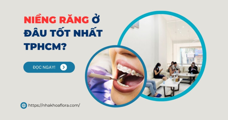 niềng răng ở đâu tốt TPHCM