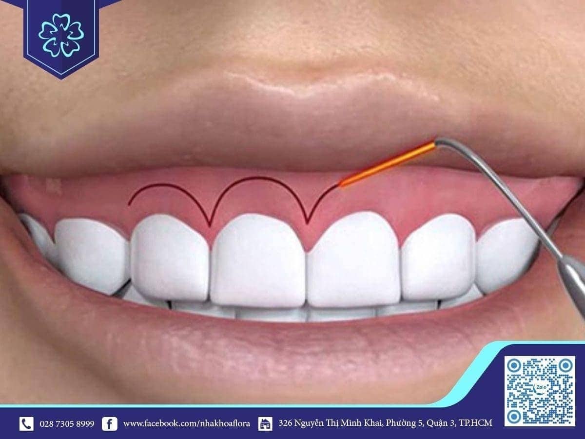 Laughing can cure it.