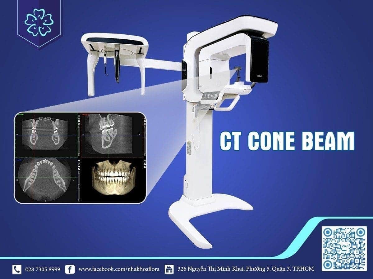 Máy CT Cone Beam tại Nha Khoa Flora - Thiết bị hỗ trợ cấy ghép răng Implant