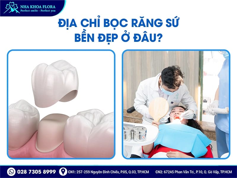Bọc răng sứ có bền không? - Ảnh 5