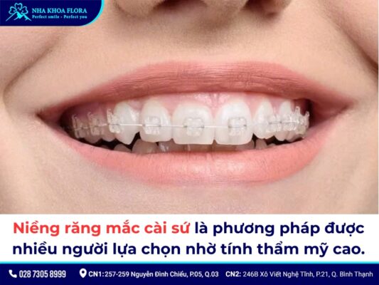 Các loại niềng răng - ảnh 2