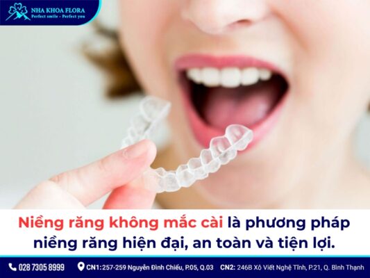 Các loại niềng răng - ảnh 5
