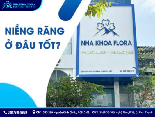 Các loại niềng răng - ảnh 8