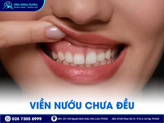 biến chứng sau phẫu thuật hở lợi - ảnh 3