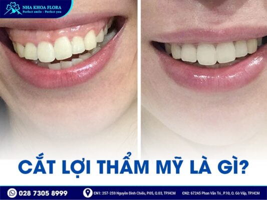 cắt lợi có đau không - ảnh 1