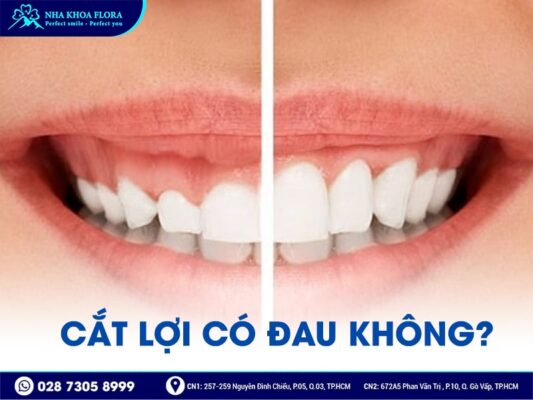 cắt lợi có đau không - ảnh 2