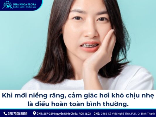 chia sẻ kinh nghiệm niềng răng - ảnh 1