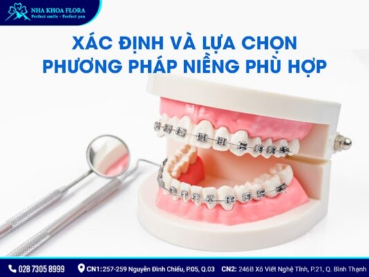 chia sẻ kinh nghiệm niềng răng - ảnh 2