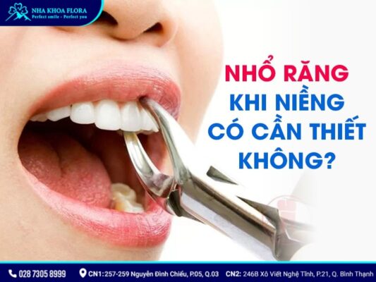 chia sẻ kinh nghiệm niềng răng - ảnh 4