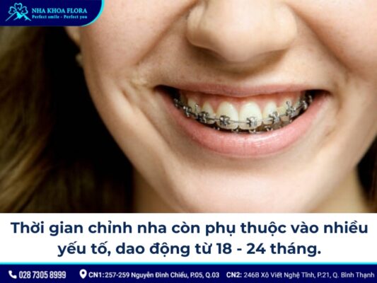 chia sẻ kinh nghiệm niềng răng - ảnh 6