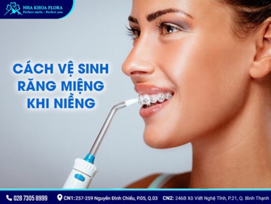 chia sẻ kinh nghiệm niềng răng - ảnh 7