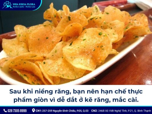 chia sẻ kinh nghiệm niềng răng - ảnh 8