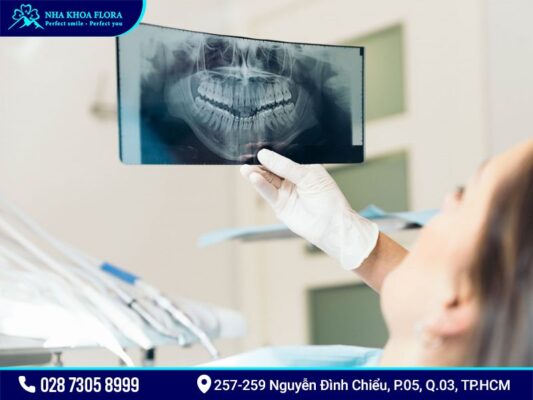 chụp x quang trước khi niềng răng - ảnh 1