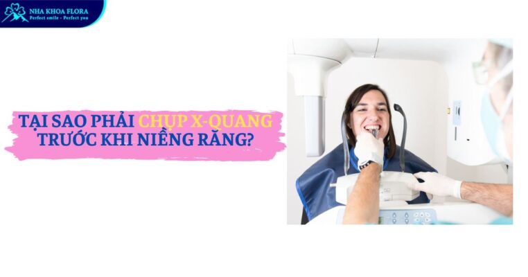 chụp x quang trước khi niềng răng