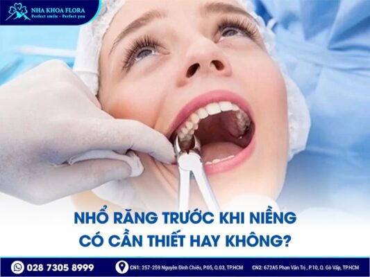 có nên nhổ răng trước khi niềng - ảnh 1