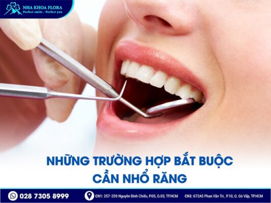 có nên nhổ răng trước khi niềng - ảnh 3