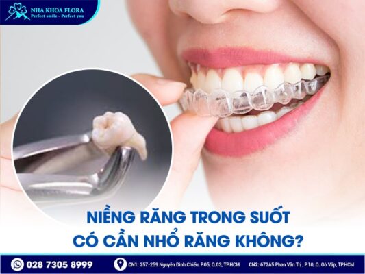 có nên nhổ răng trước khi niềng - ảnh 4