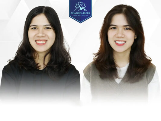 biến chứng cười hở lợi - ảnh 5