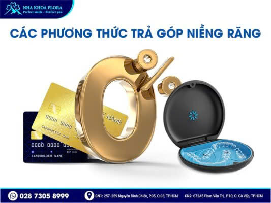 niềng răng trả góp - ảnh 2