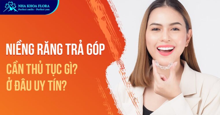 niềng răng trả góp
