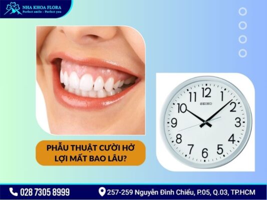 phẫu thuật cười hở lợi mất bao lâu - ảnh 1