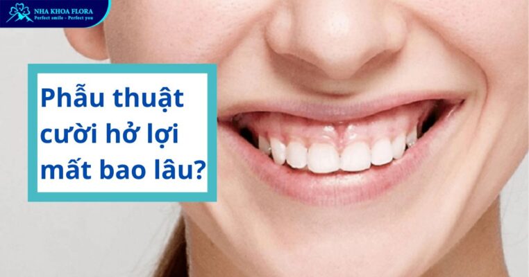 phẫu thuật cười hở lợi mất bao lâu