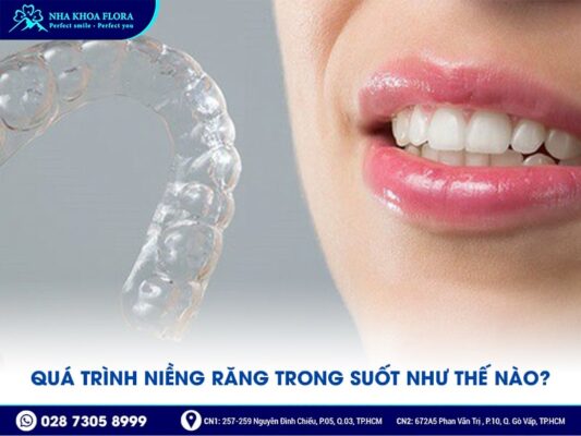 quá trình niềng răng trong suốt - ảnh 2