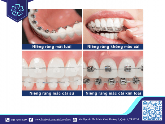 Mỗi phương pháp niềng răng đều không tác động xấu đến hàm