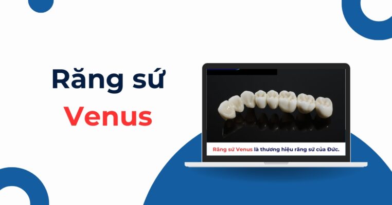 răng sứ Venus