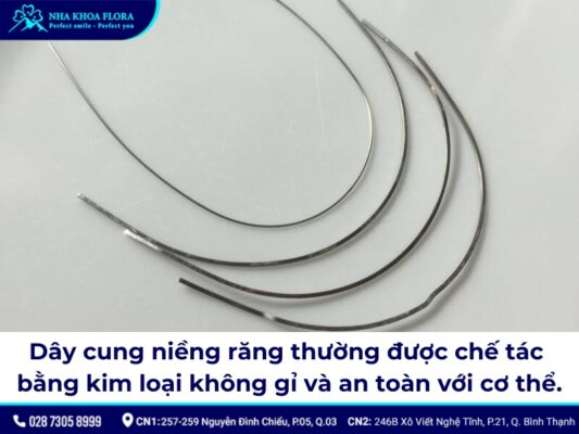 dây cung niềng răng - ảnh 3