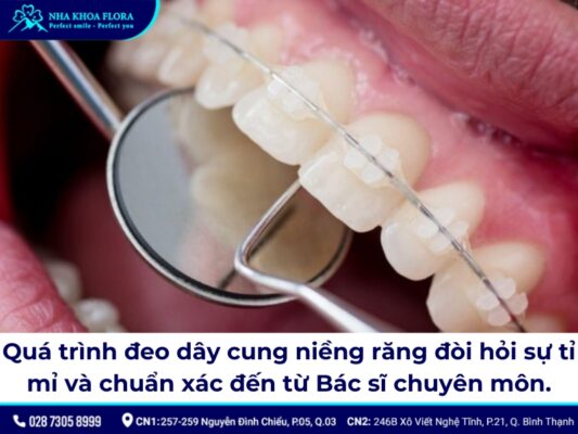 dây cung niềng răng - ảnh 4