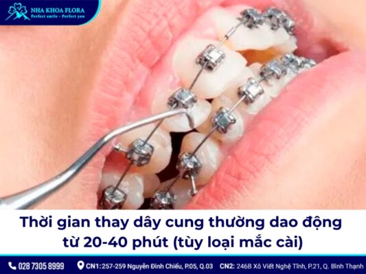 dây cung niềng răng - ảnh 5