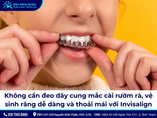dây cung niềng răng - ảnh 6