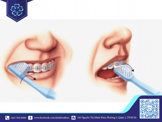 Vệ sinh răng miệng đúng cách để giữ răng miệng khỏe mạnh