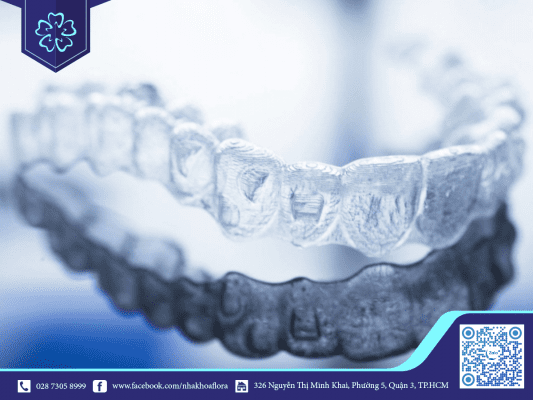 Thời gian đeo niềng răng bao lâu phụ thuộc vào chế độ chăm sóc răng miệng