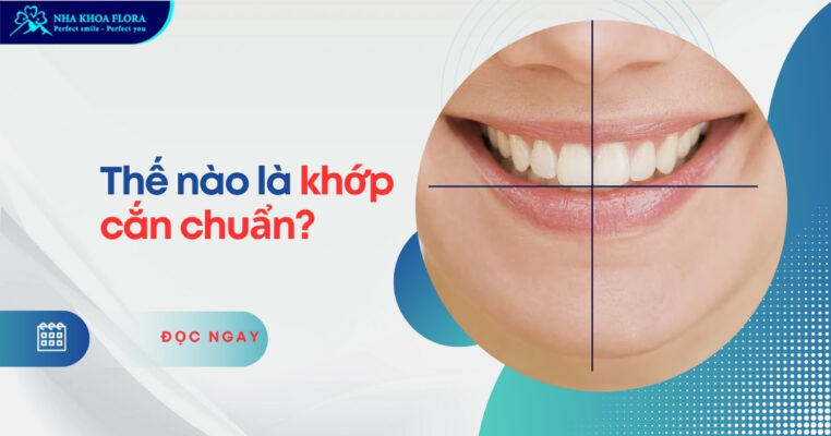 Khớp cắn chuẩn