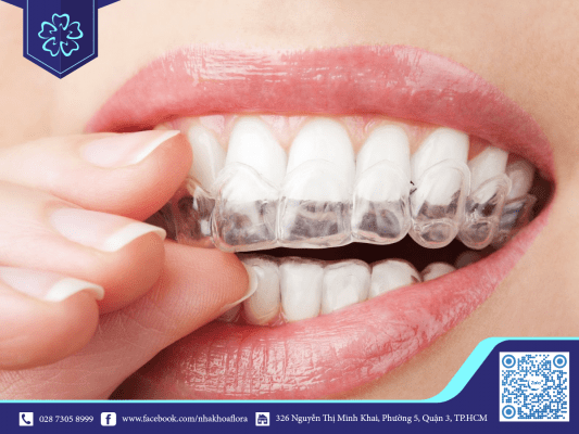 do-tuoi-moc-rang-khon-roi-vao-18-25 Độ tuổi mọc răng khôn rơi vào 18 - 25 tuổi