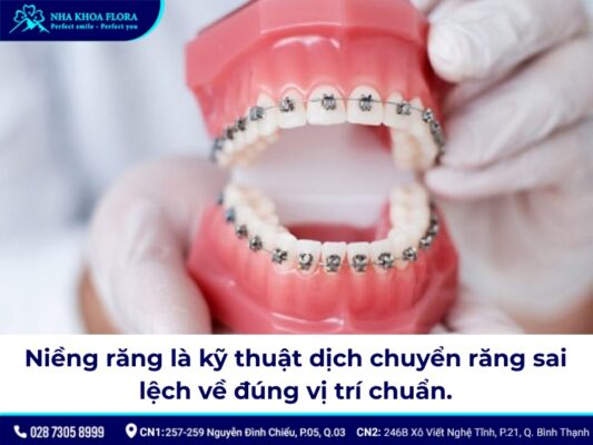 Niềng răng có làm răng yếu đi? - ảnh 1