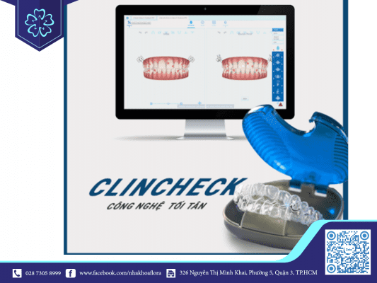 nieng-rang-invisalign-biet-truoc-ket-qua-nieng Niềng răng Invisalign biết trước kết quả niềng