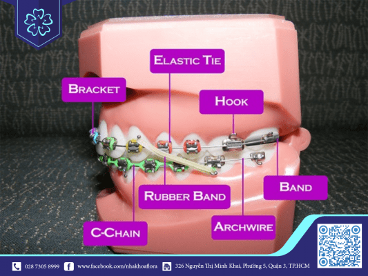 Các thuật ngữ nha khoa niềng răng cần biết