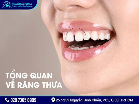Răng thưa có niềng được không - ảnh 1
