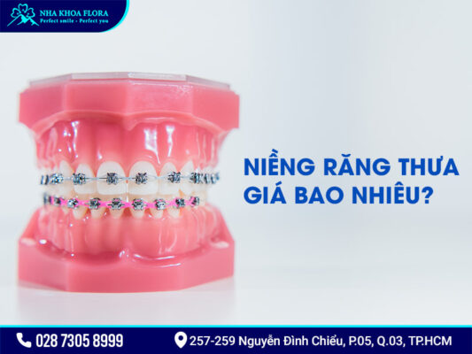 Răng thưa có niềng được không - ảnh 5