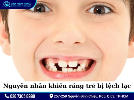 Trẻ em nên niềng răng khi nào? - ảnh 1 Trẻ em nên niềng răng khi nào? - ảnh 1