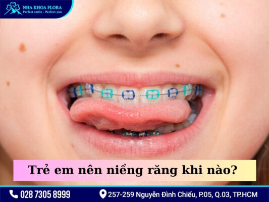 Trẻ em nên niềng răng khi nào? - ảnh 2 Trẻ em nên niềng răng khi nào? - ảnh 2