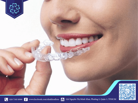 Niềng răng Invisalign - xu hướng niềng răng hiện đại