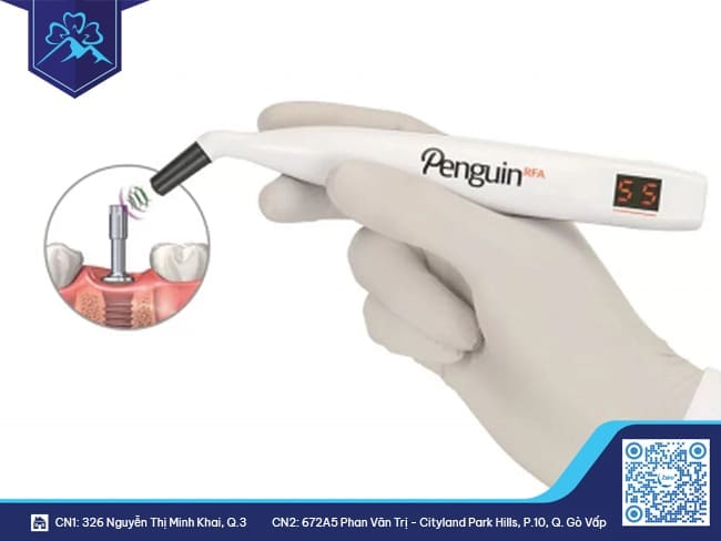 Ưu điểm về thiết bị Implant - PenguinRFA
