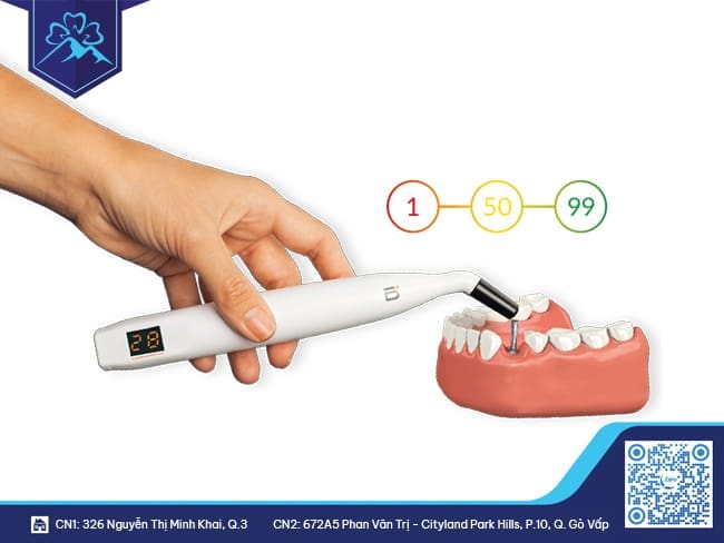 Cơ chế hoạt động của thiết bị Implant - PenguinRFA