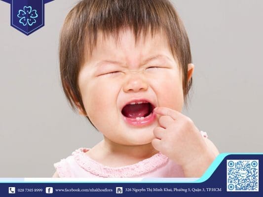 QUÁ TRÌNH THAY RĂNG CỦA TRẺ GẶP VẤN ĐỀ GÌ? 8