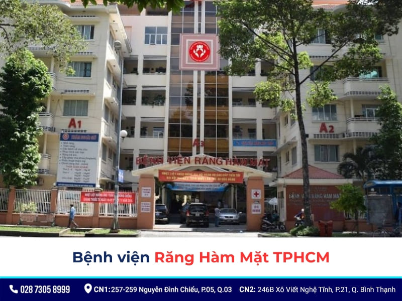 bọc răng sứ ở đâu tốt nhất